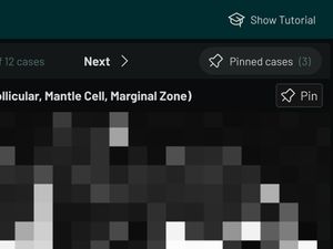 A closeup of part of the Radioeye UI, showing the button to pin as case, and the button to view the list of pinned cases