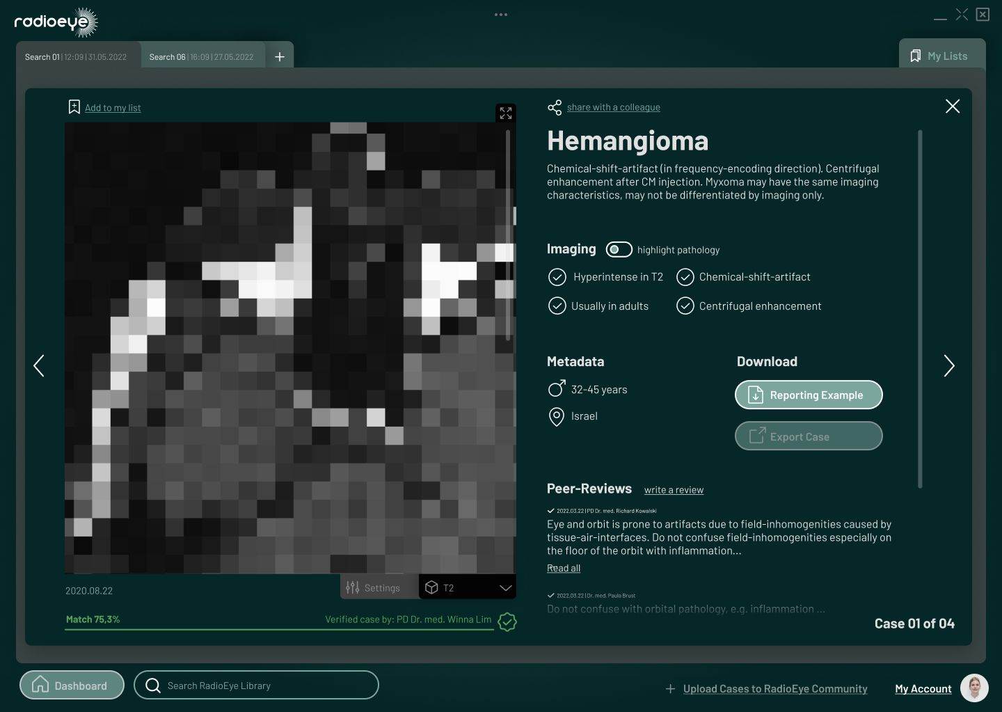 The initial UI mockups we received for Radioeye