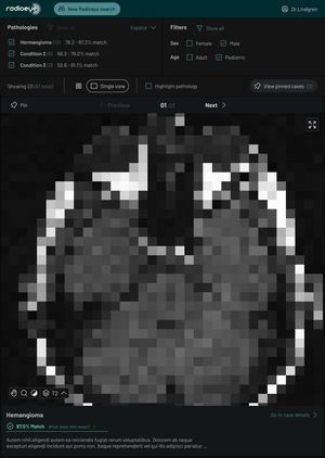 A large MRI scan of a human head showing the brain and eyeballs, with UI for navigating available cases
